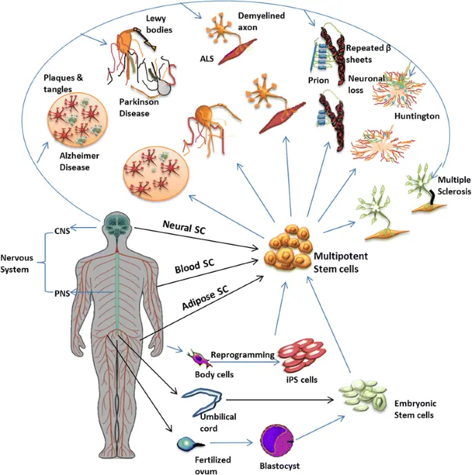 Un grafico che illustra le potenziali malattie che i trattamenti con cellule staminali potrebbero affrontare nel campo della neurologia.