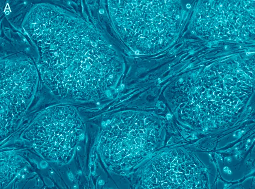 Come massimizzare i benefici della terapia con cellule staminali