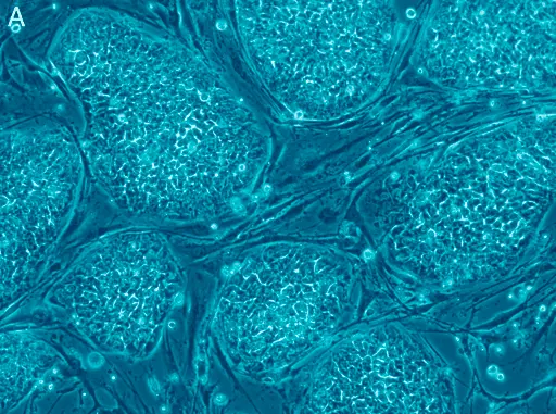 Come massimizzare i benefici della terapia con cellule staminali