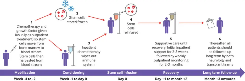Una rappresentazione di una procedura di trapianto di cellule staminali in ambito clinico