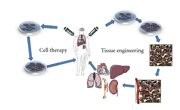 Un diagramma che illustra il processo della terapia con cellule staminali
