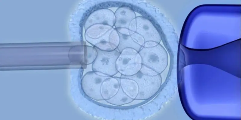 Uno studio rileva l'efficacia delle cellule staminali derivate dal cordone ombelicale nei pazienti affetti da paralisi cerebrale