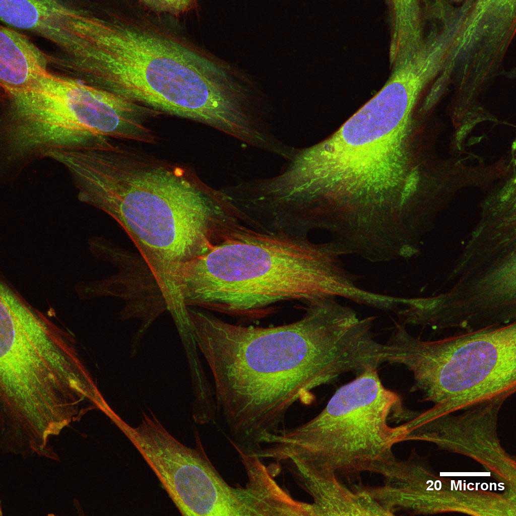 Cellule staminali UCMSC