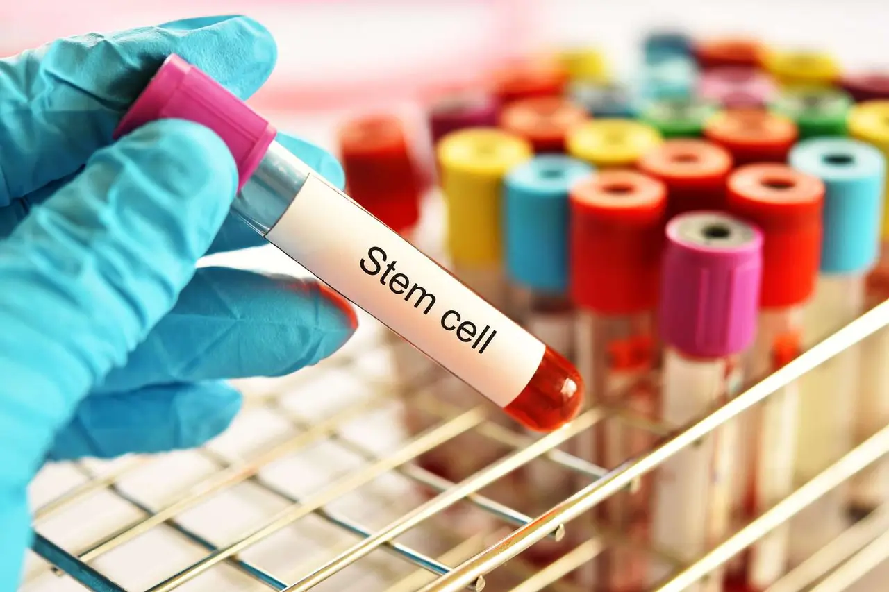 Conservazione delle Cellule Staminali: Cosa Devi Sapere