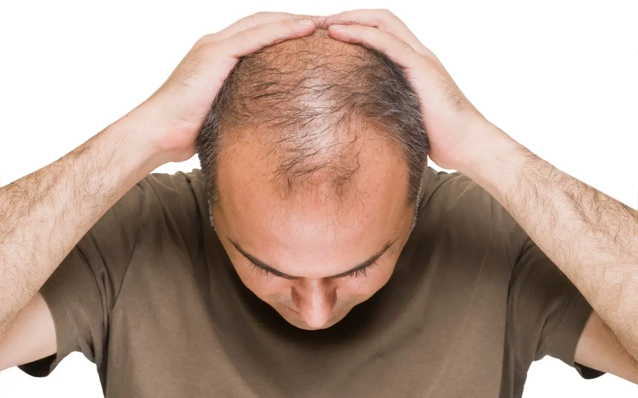 Il potenziale della terapia con cellule staminali per la caduta dei capelli