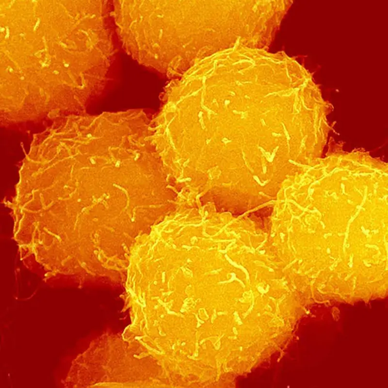 Cellule staminali derivate dal sangue del cordone ombelicale (UCBSC)