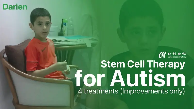 Terapia con cellule staminali per l'autismo - Miglioramenti dopo 4 trattamenti