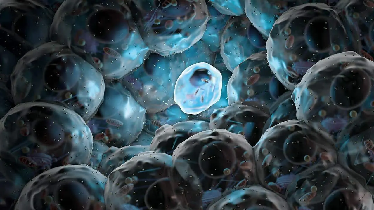 Als e terapia con cellule staminali