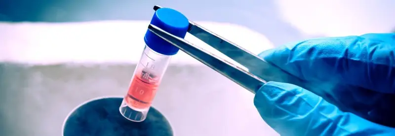 La terapia con cellule staminali per il morbo di Crohn è stata approvata in Europa