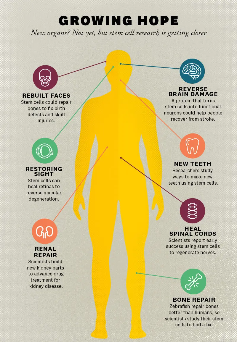 Un'infografica che illustra come le cellule staminali possono essere utilizzate nelle terapie anti-invecchiamento
